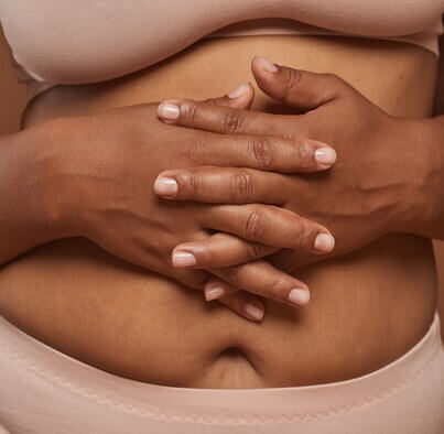 Fibroids
