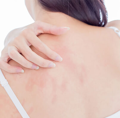 Skin Disorders 2