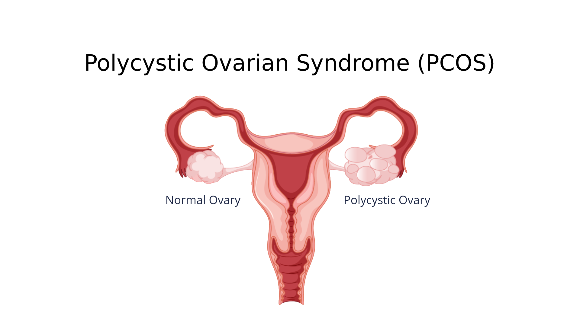 Gynecological Disorders - The Ayurvedic Clinic