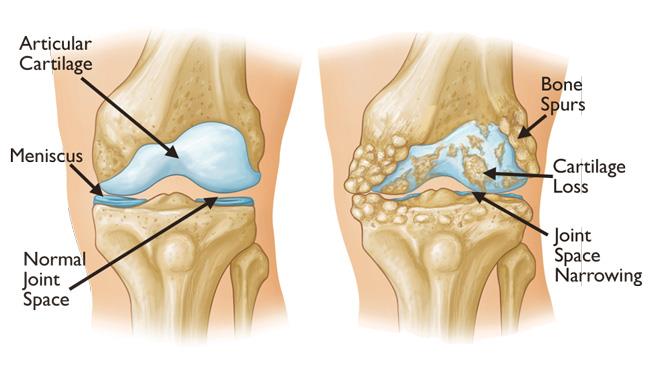 A00389F02 Pain Management Clinic - The Ayurvedic Clinic