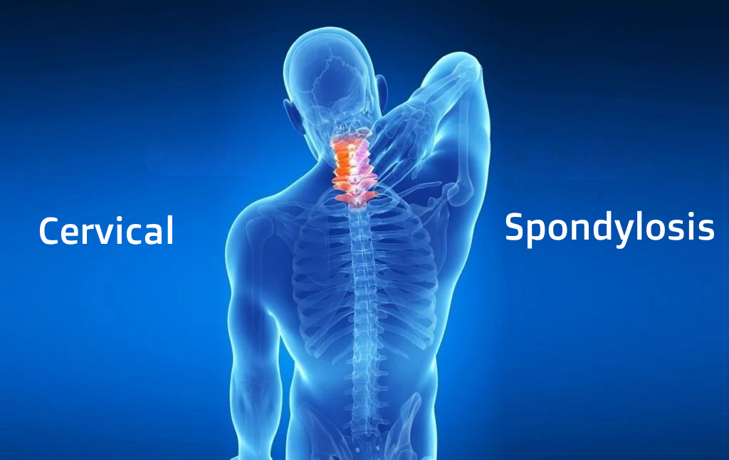 Varma-Cervical-1-1024X647 Pain Management Clinic - The Ayurvedic Clinic