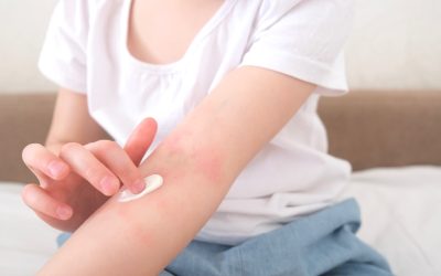 How Can Ayurveda Help Soothe Eczema-Prone Skin